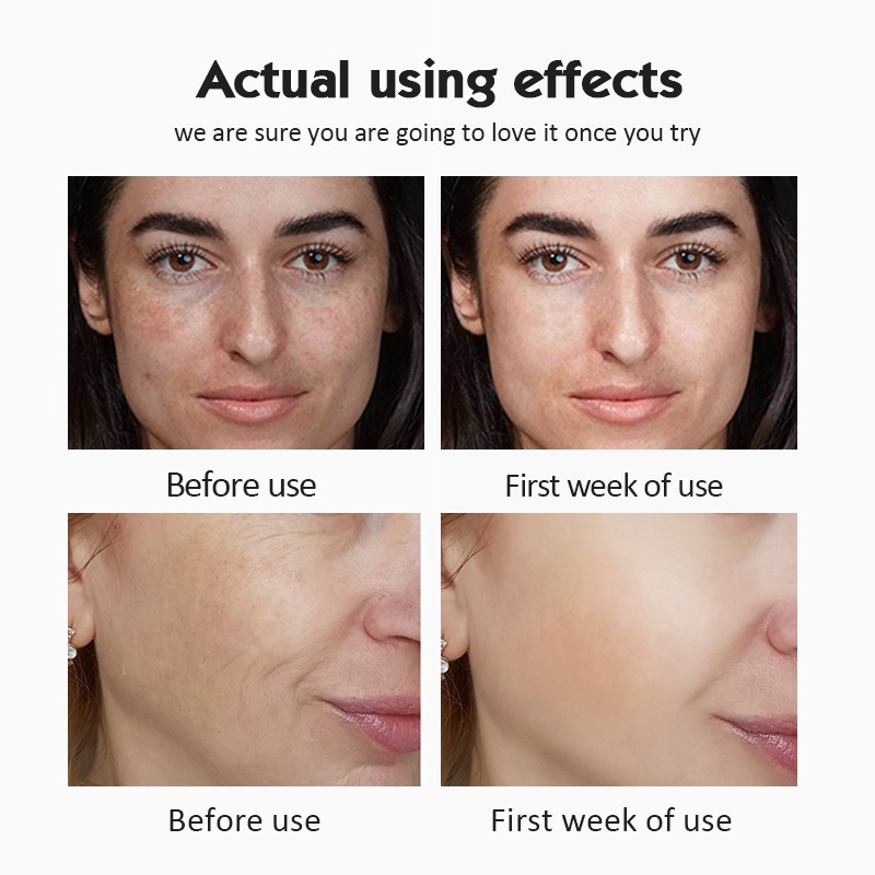 20% C Vitamini Ampul Serum Set - Luxury Skincare Wholesale incelemesi ve fiyatı