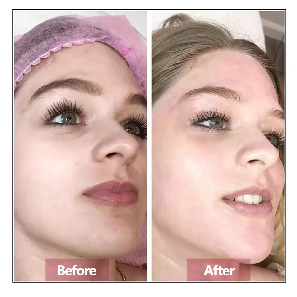 Hyaluronik asit yüz Serum özü  - Luxury Skincare Wholesale incelemesi ve fiyatı